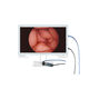 1080P 50fps 60fps CMOS medical endoscope camera Light Source 27 inch Monitor Medical Imaging system